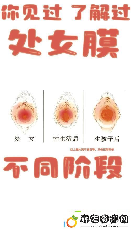 勇敢迎接生活的轉(zhuǎn)折——“處破女處破全過第一次”的心路歷程
