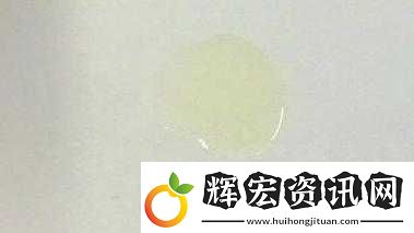 胡桃尿道里有白色粘液要警惕
